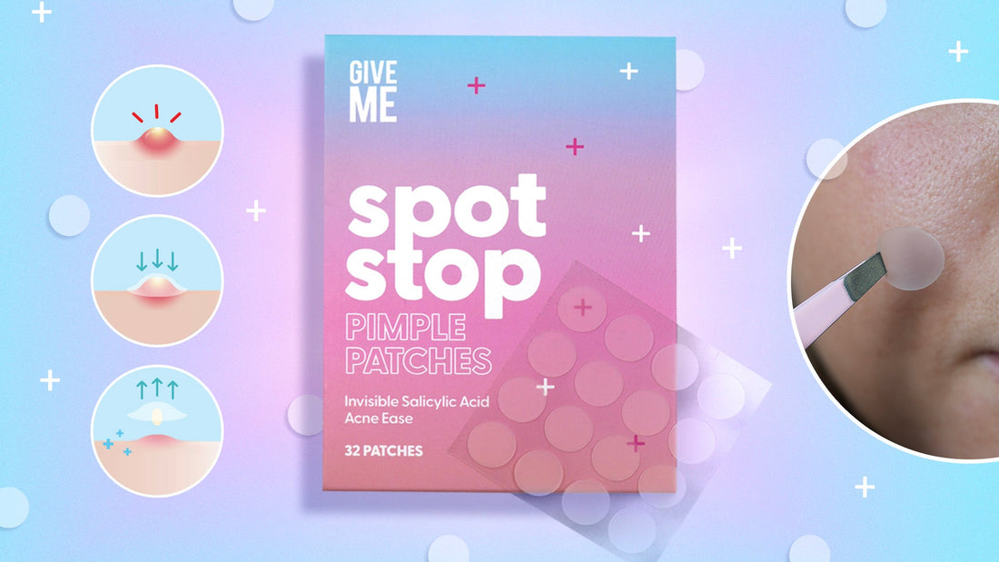 Meet Your New Spot Saviours! - Give Me Cosmetics