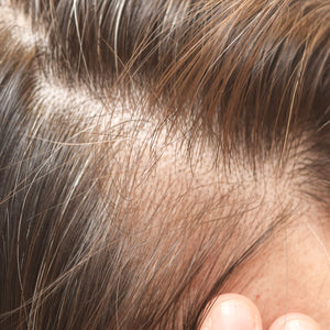 Best Shampoo For Hair Growth & Thinning