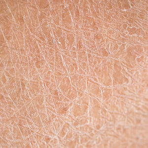 Keratosis Pilaris & Rough Skin