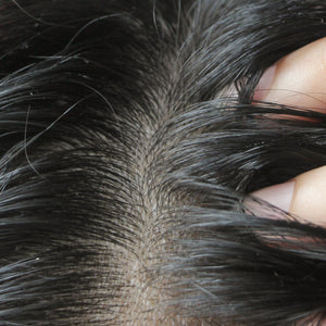 Oily & Greasy Hair Solutions