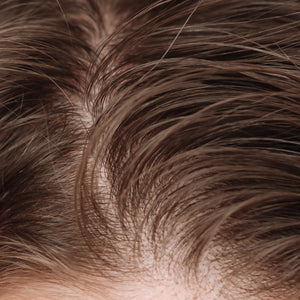 Scalp Buildup & Acne Care Collection